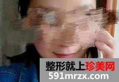 ע�䲣��������ϴ�ǰ��Ա�Ч��ͼƬ�ͻָ�����