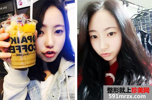 ���������¡����ǰ��Ч���Ա�ͼ�ͻָ�����