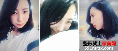 ���������¡����ǰ��Ч���Ա�ͼ�ͻָ�����