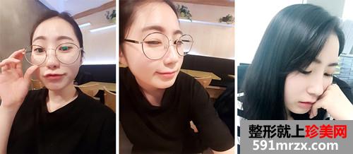 ���������¡����ǰ��Ч���Ա�ͼ�ͻָ�����