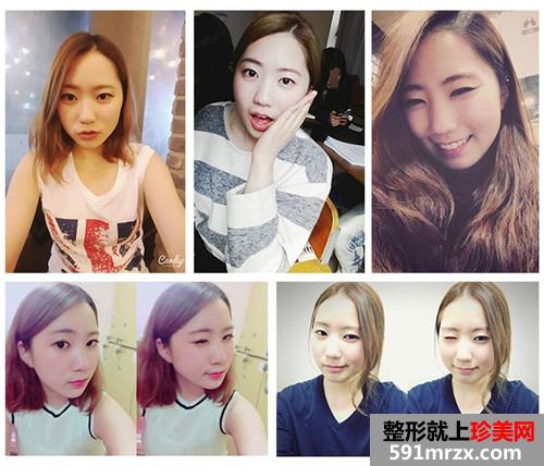 ���������¡����ǰ��Ч���Ա�ͼ�ͻָ�����