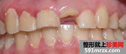 ��ֲ��,ǰ��,�Ա�,Ч��,ͼƬ,�ָ�,����