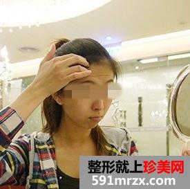 �沿�ڿ���ȥ��̧ͷ��ǰ��Ա�Ч��ͼƬ�ͻָ�����