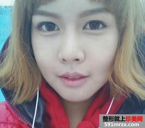 �ذ���,����,����,�ָ�,����,ǰ��,�Ա�,Ч��ͼ