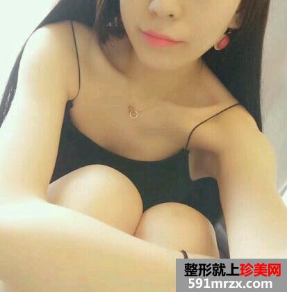 娜绮丽隆胸一个月 娜绮丽隆胸前后对比照