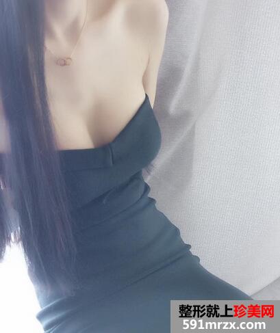 娜绮丽隆胸一个月 娜绮丽隆胸前后对比照