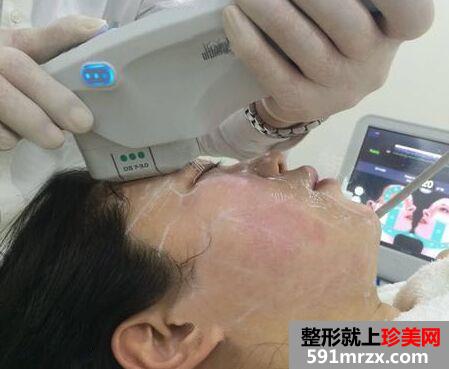 ����������������沿����Ч������