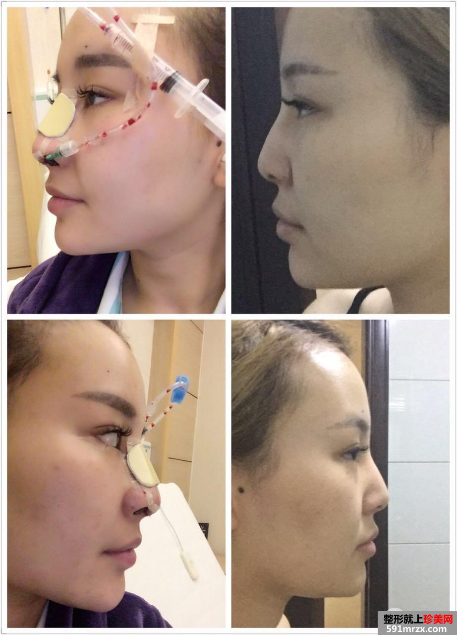 ��ϸ�����ҵı��ۺ�������ʵ�����ָ�ǰ��Ա�ͼ