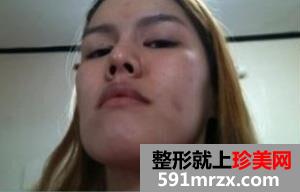 �ذ���,����,����,�ָ�,����,ǰ��,�Ա�,Ч��ͼ