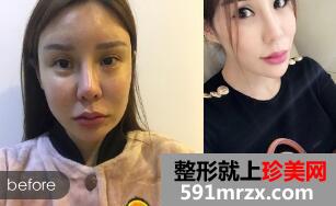 40��������������ǰ�����ͼ������������ǰ��Ա�ͼ