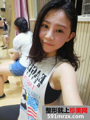 耳软骨鼻综合加眼综合手术恢复日记分享给大家