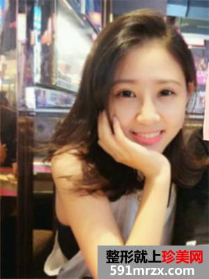 耳软骨鼻综合加眼综合手术恢复日记分享给大家