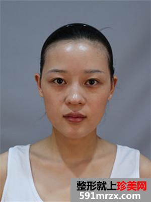 �ུ�+��״üЧ��ͼƬ�ԱȻ��лָ�����Ŷ