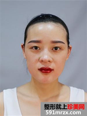 �ུ�+��״üЧ��ͼƬ�ԱȻ��лָ�����Ŷ