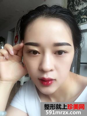 �ུ�+��״üЧ��ͼƬ�ԱȻ��лָ�����Ŷ