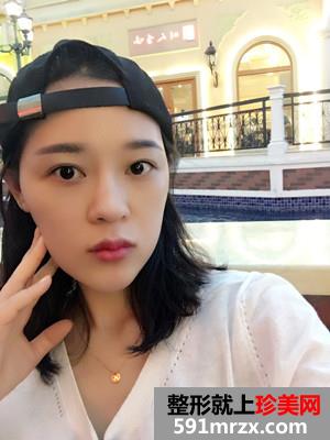 �ུ�+��״üЧ��ͼƬ�ԱȻ��лָ�����Ŷ