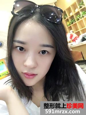 �ུ�+��״üЧ��ͼƬ�ԱȻ��лָ�����Ŷ