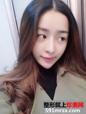 ���ۺ�ʧ���޸������ָ�ȫ������ǰ���նԱ�