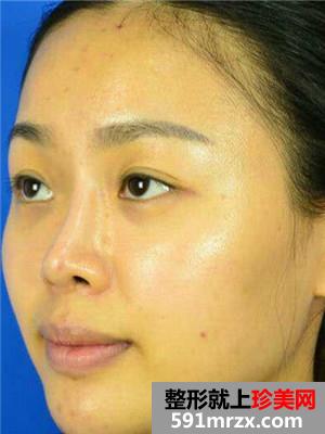 ���ۺ�ʧ���޸������ָ�ȫ������ǰ���նԱ�