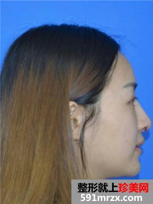 ���ۺ�ʧ���޸������ָ�ȫ������ǰ���նԱ�