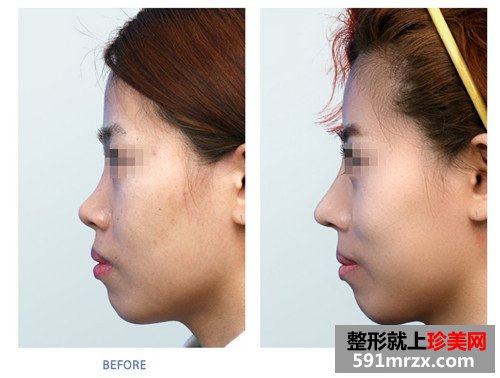 ����������¡�ǻ�Ӱ�������