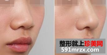 ����������¡�ǻ�Ӱ�������