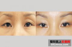 �۲��޸����ʺ���������