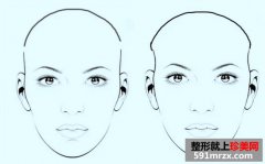 ��̫��Ѩ�ļ۸�