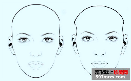 ��̫��Ѩ�ļ۸�