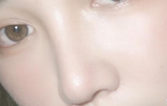做了鼻子之后一般什么时候正常 做了鼻子之后一般什么时候正常