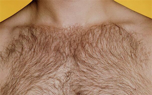 种植胸毛的危害 种植胸毛的危害