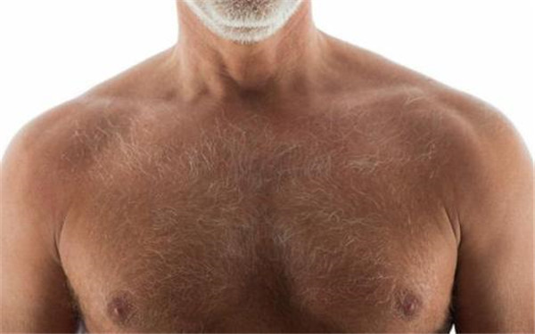 种植胸毛价格 种植胸毛价格