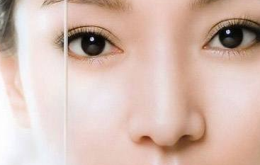 刚做完双眼皮能吃咸蛋黄吗