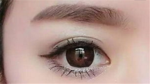 双眼皮修复会有疤痕吗