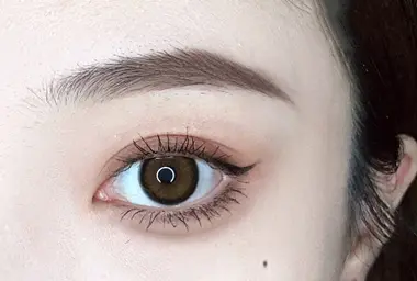 做完眼袋手术需要躺几天