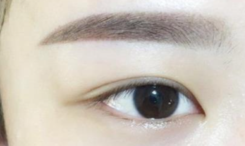 做眼袋风险大不大