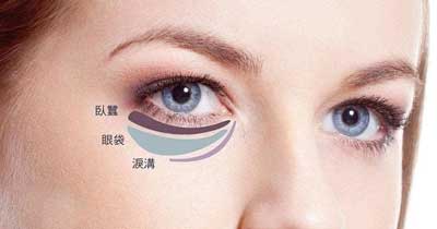 三分钟去眼袋是什么技术