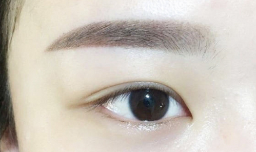 割眼袋需要注意些什么