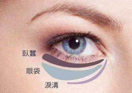 激光可以去眼袋吗 激光可以去眼袋吗