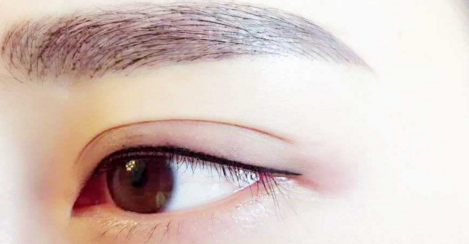 ��΢��˫��Ƥ��Ҫע��ʲô