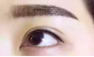 ��ȫ��˫��Ƥ�۲���