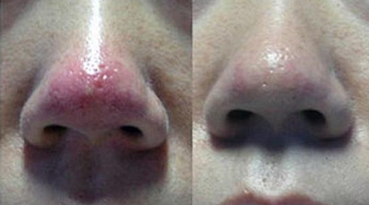 �������ô��