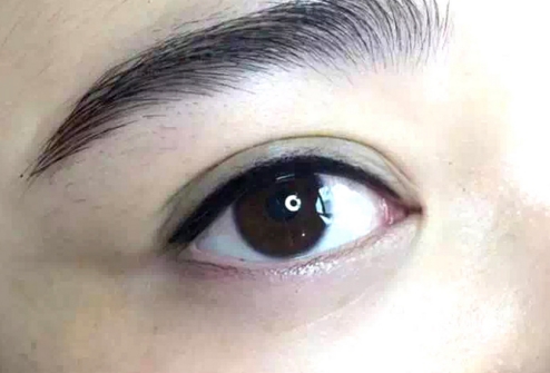 深圳去眼袋哪个医院好