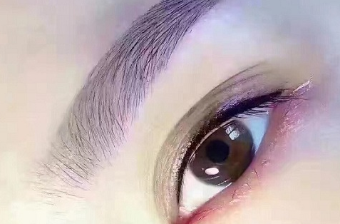 眼袋切除术优点