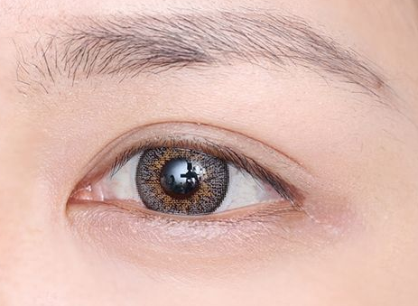 成都开眼角的价钱