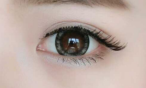 开眼角手术多久恢复
