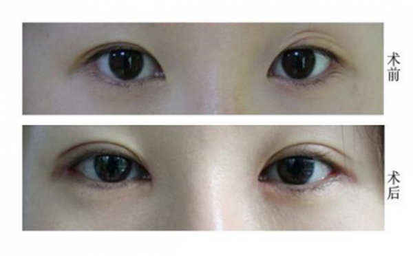 ���۽Ǽɿڶ��