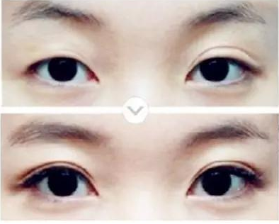 ����Ӱ��˫��Ƥ�ָ���