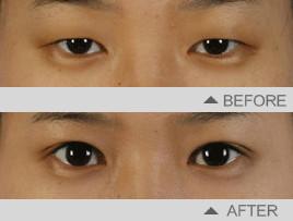 ������ͬʱ���������