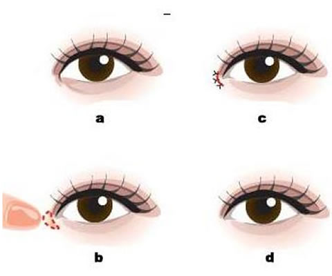 �����۲�����������Ǯ